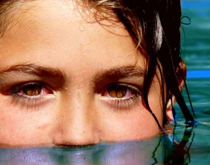 Why does my eye burn when I swim?